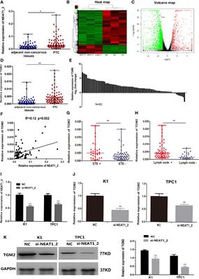 The NEAT1_2/miR-491 Axis Modulates Papillary Thyroid Cancer Invasion and Metastasis Through TGM2/NFκb/FN1 Signaling